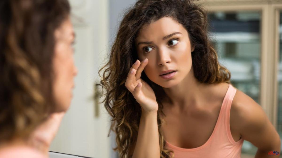Tips to prevent dark circles concealer from cracking