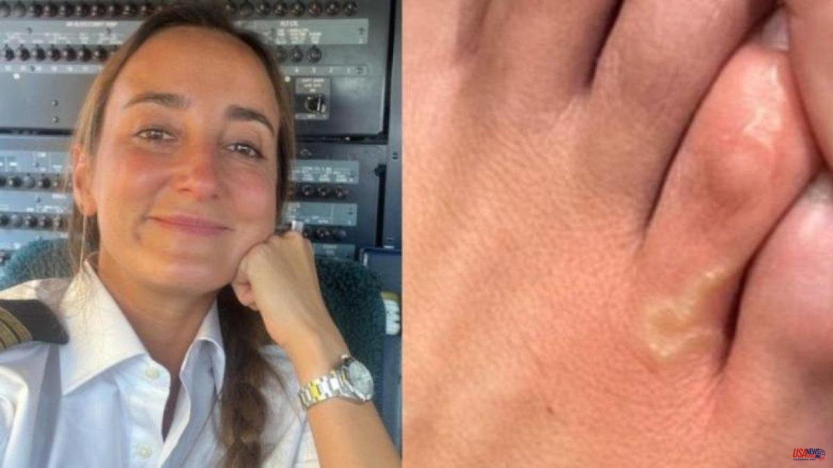 Lucía Pombo has a worm inside her toe and notices how it moves: "Does it stay dead in there?"