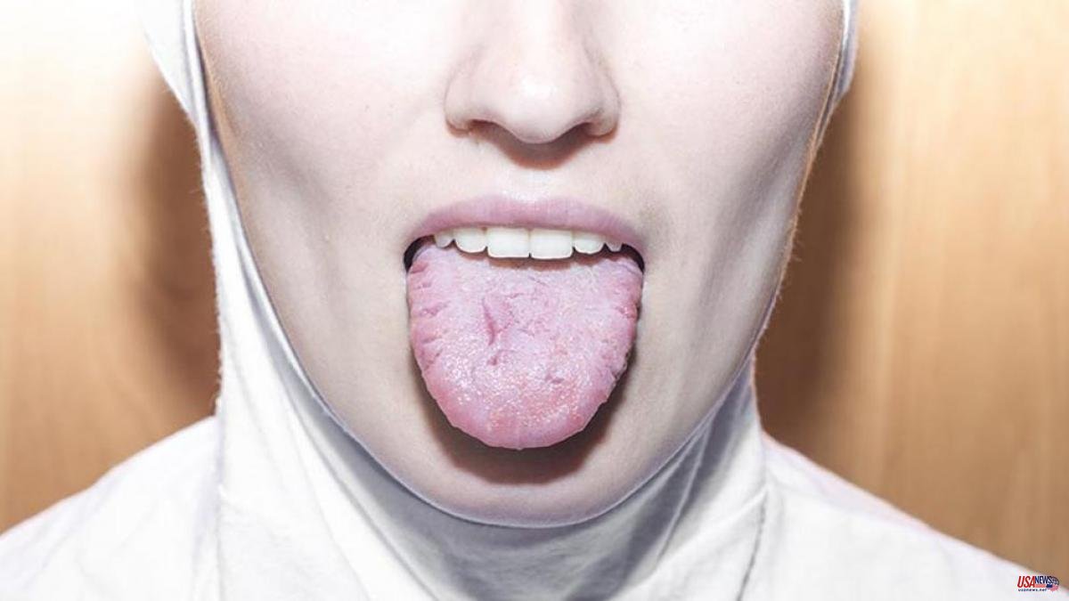 What is glossitis? | Symptoms, causes and how to treat the disease