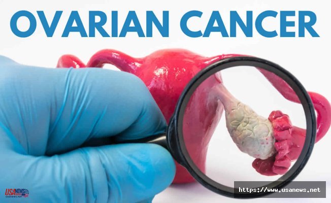 Navigating Ovarian Cancer Diagnosis and Care