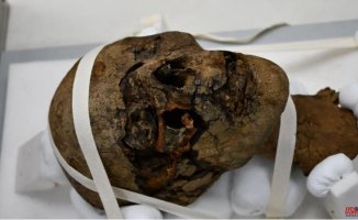 The mummified head found in an attic belonged to a woman with dental problems
