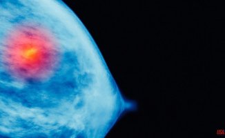 A breast cancer test created in Spain, chosen as one of the best inventions of the year