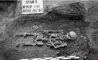 The medieval burial of a man who had two different types of dwarfism