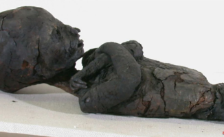 The disease that affected a third of children in Ancient Egypt