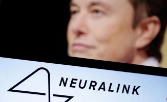 Elon Musk gets permission for Neuralink to test his brain implants in humans