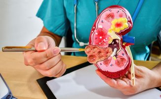 Early detection, key to overcoming kidney cancer