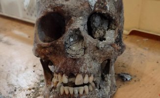 Teeth from 600 years ago confirm the effectiveness of lockdowns in the face of pandemics