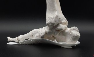 Plantar fasciitis after summer: why insoles are essential for recovery?