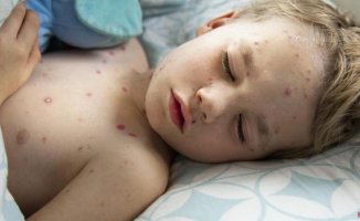 These are the most contagious diseases in school-age children
