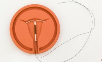 Everything you need to know before getting an IUD