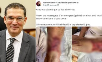 The impressive injury of Jaume Alonso-Cuevillas from the bite of a huge grouper