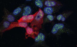 Scientists from Barcelona open the way to prevent breast cancer metastasis