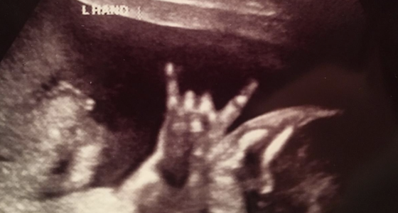 Sweet child o’ mine! The baby in this sonogram video flashes a ‘rock on’ sign